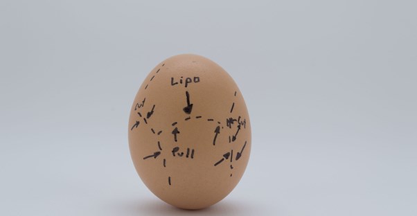 a liposuction egg