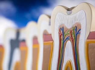 Tooth Decay: 7 Terms to Know