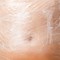 Debunking Body Wraps for Weight Loss