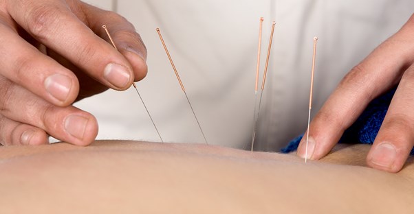 a practitioner who knows the health benefits of acupuncture