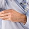 Excessive Sweating: When to Be Concerned 