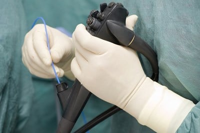 Reasons for an Endoscopy 